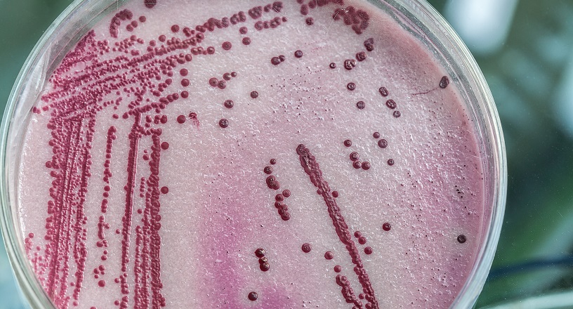 Chris Mee Group Legionella