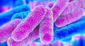legionella