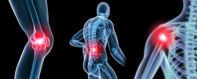 Musculoskeletal Disorder